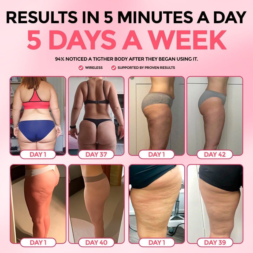 SmoothSkin™ Cellulite Solution